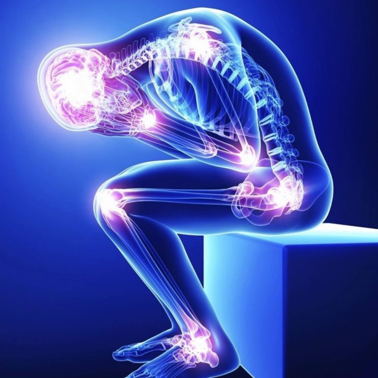 Simptome de neurologie in afectiunile reumatologice