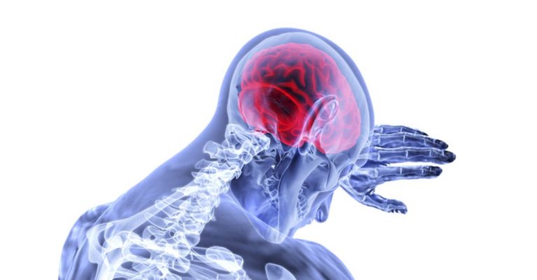 encefalita, cauze, simptome si tratament