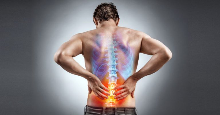 Sciatica se resimtite pe nervul sciatic