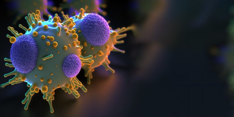 gliom la nivel celular | Neuroaxis