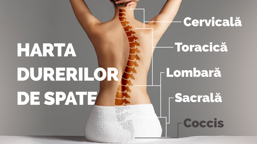 harta durerilor de spate, infografic | Neuroaxis Bucuresti